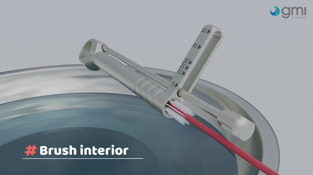 نحوه تمیز کردن صحیح رچت نحوه تمیز کردن صحیح رچت